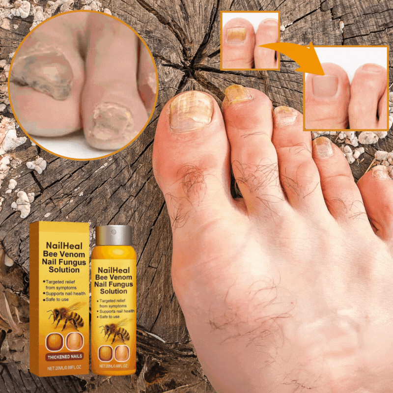 NailHeal™